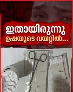 ശസ്ത്രക്രിയ വിജയകരം; ഉഷ ജോസഫിന്റെ വയറ്റിലെ കത്രിക പുറത്തെടുത്തു