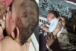 മലപ്പുറത്ത് തെരുവ് നായ ഭീതി: അഞ്ച് മാസം പ്രായമുള്ള കുഞ്ഞിനടക്കം നാല് പേർക്ക് കടിയേറ്റു
